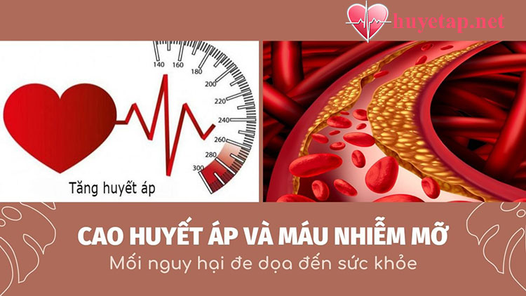 Cao huyết áp và máu nhiễm mỡ - Mối nguy hại đe dọa sức khỏe - Huyetap.net