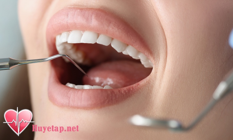 3. Ngăn ngừa sâu răng như thế nào? 1