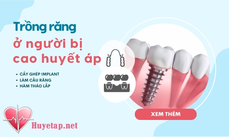 Người bị cao huyết áp cần lưu ý gì khi trồng răng implant? 1